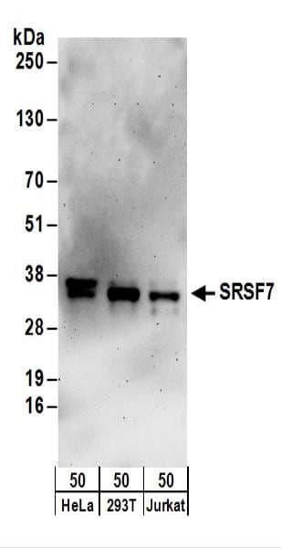 IHC-plus™ SFRS7 / 9G8 Antibody (aa188-238)