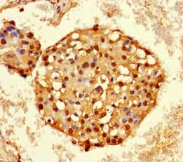 HNRNPA2B1 Antibody