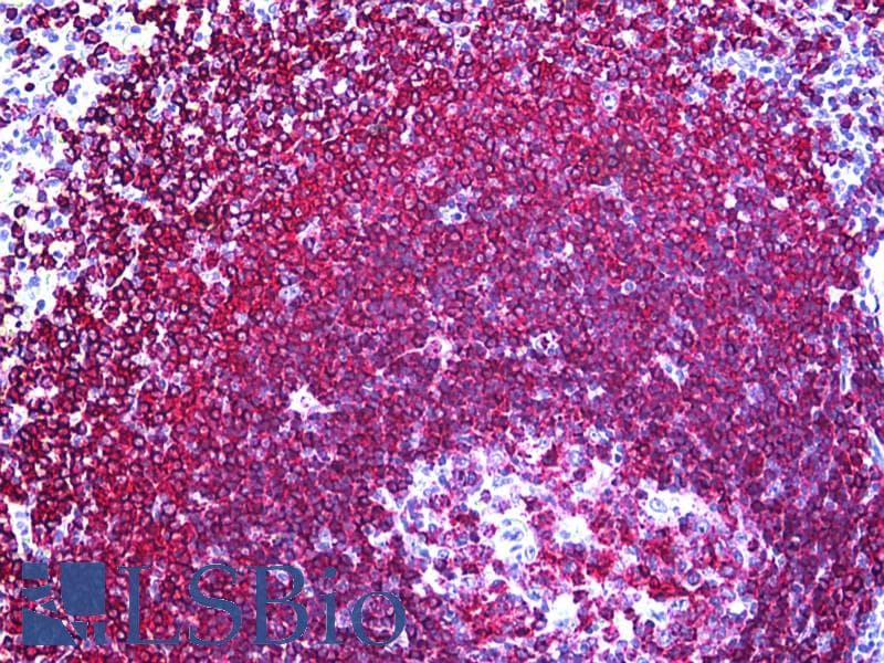 IHC-plus™ Monoclonal Mouse anti-Human B cell Antibody (clone MB1, Concentrated, IHC)