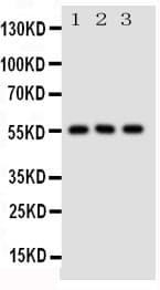 Polyclonal Rabbit anti-Mouse SLC2A5 / GLUT5 Antibody (aa232-251, IHC, WB)