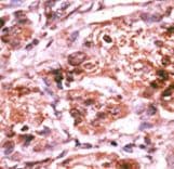 Polyclonal Rabbit anti-Human CDC25A Antibody (phospho-Ser293, IHC, WB)