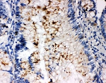 SSX2 Antibody (aa47-74)