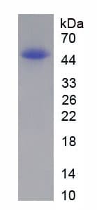 Human NPPA / ANP Protein (Recombinant His, N-Terminal)