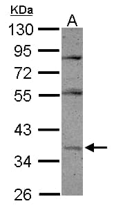 IHC-plus™ PON1 / ESA Antibody