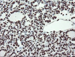Monoclonal Mouse anti-Human NONO / P54NRB Antibody (clone OTI2E7, IHC, WB)