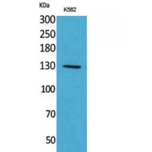 Polyclonal Rabbit anti-Human APAF1 / APAF-1 Antibody (501-550 aa, Internal, IHC, WB)