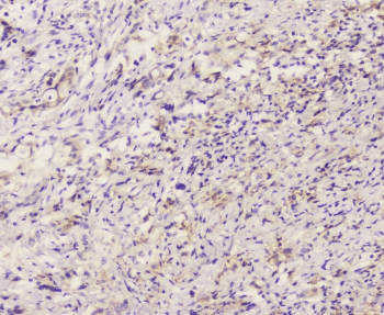 EML4 Antibody