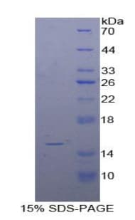 Bovine IL15 Protein (Recombinant His)
