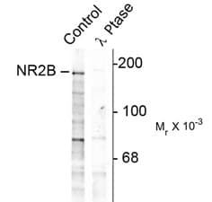 GRIN2B / NMDAR2B / NR2B Antibody (phospho-Tyr1252)