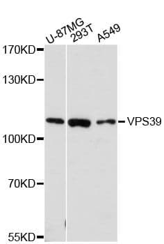 VPS39 Antibody