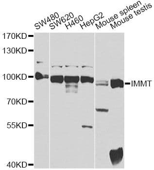 Polyclonal Rabbit anti-Human IMMT / Mitofilin Antibody (IHC, WB)