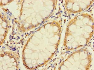 UNC93A Antibody