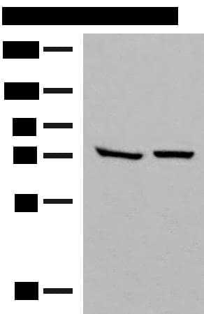 Polyclonal Rabbit anti-Human POMGNT1 Antibody (WB)