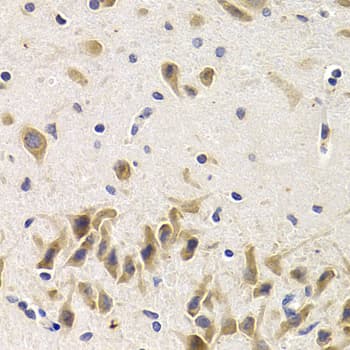 Polyclonal Rabbit anti-Human UAP1 Antibody (IHC, WB)