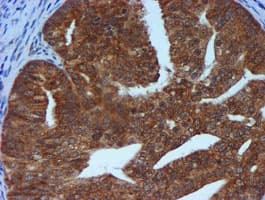 TIMP2 Antibody (clone OTI1A6, Carrier-free)