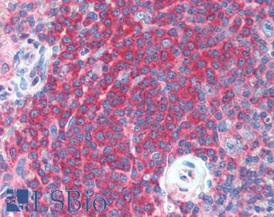 IHC-plus™ C3orf10 Antibody