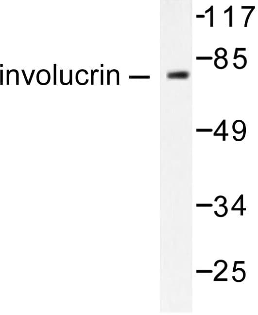 IVL / Involucrin Antibody (Pro568)