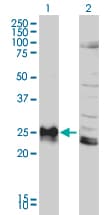 IHC-plus™ HLA-DPB1 Antibody (clone 6C6)
