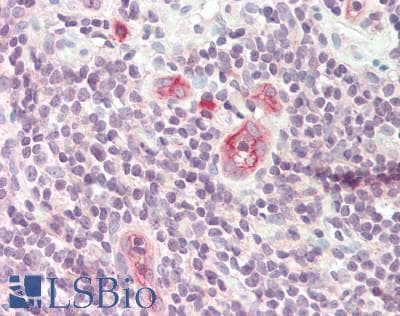 MAdCAM-1 Antibody