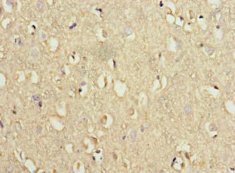 Polyclonal Rabbit anti-Human WDR60 Antibody (IHC, IF)