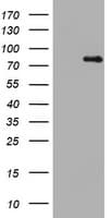 NBN / Nibrin Antibody (clone OTI6A3)