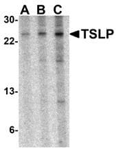 IHC-plus™ TSLP Antibody