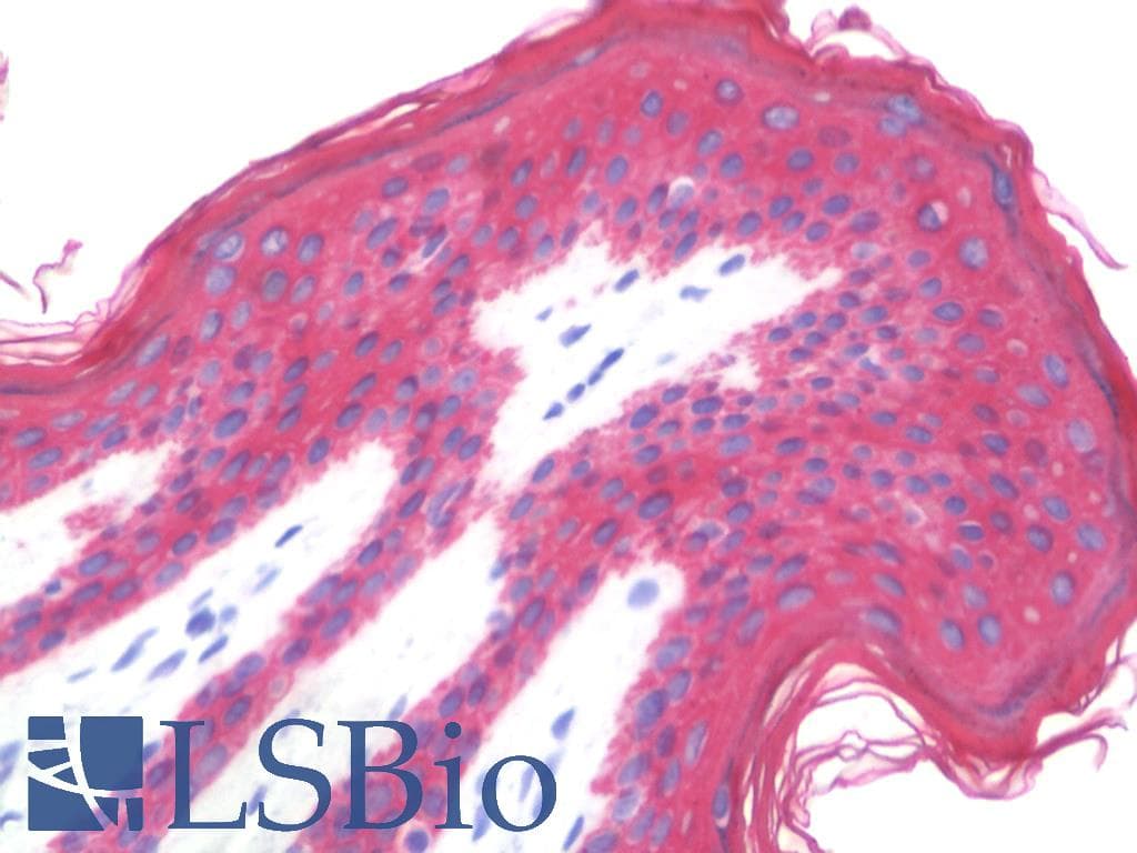 IHC-plus™ KRT8 / CK8 / Cytokeratin 8 Antibody (clone AT3D11)