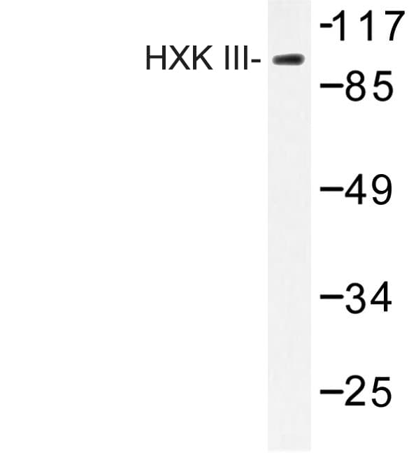 HK3 / Hexokinase 3 Antibody (Val848)