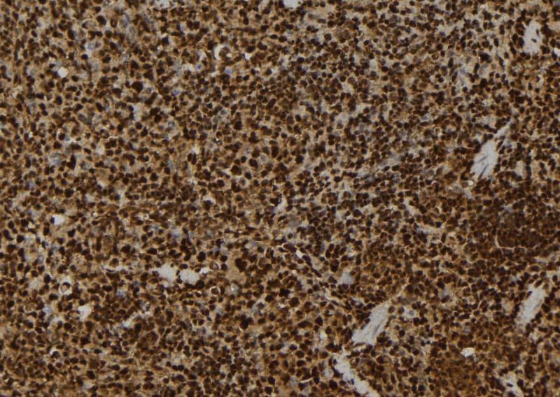 CSNK1G2 / CKI-Gamma 2 Antibody