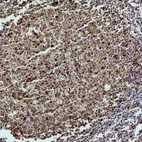 CASP3 / Caspase 3 Antibody