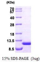 Human AHSP / EDRF Protein (Recombinant)