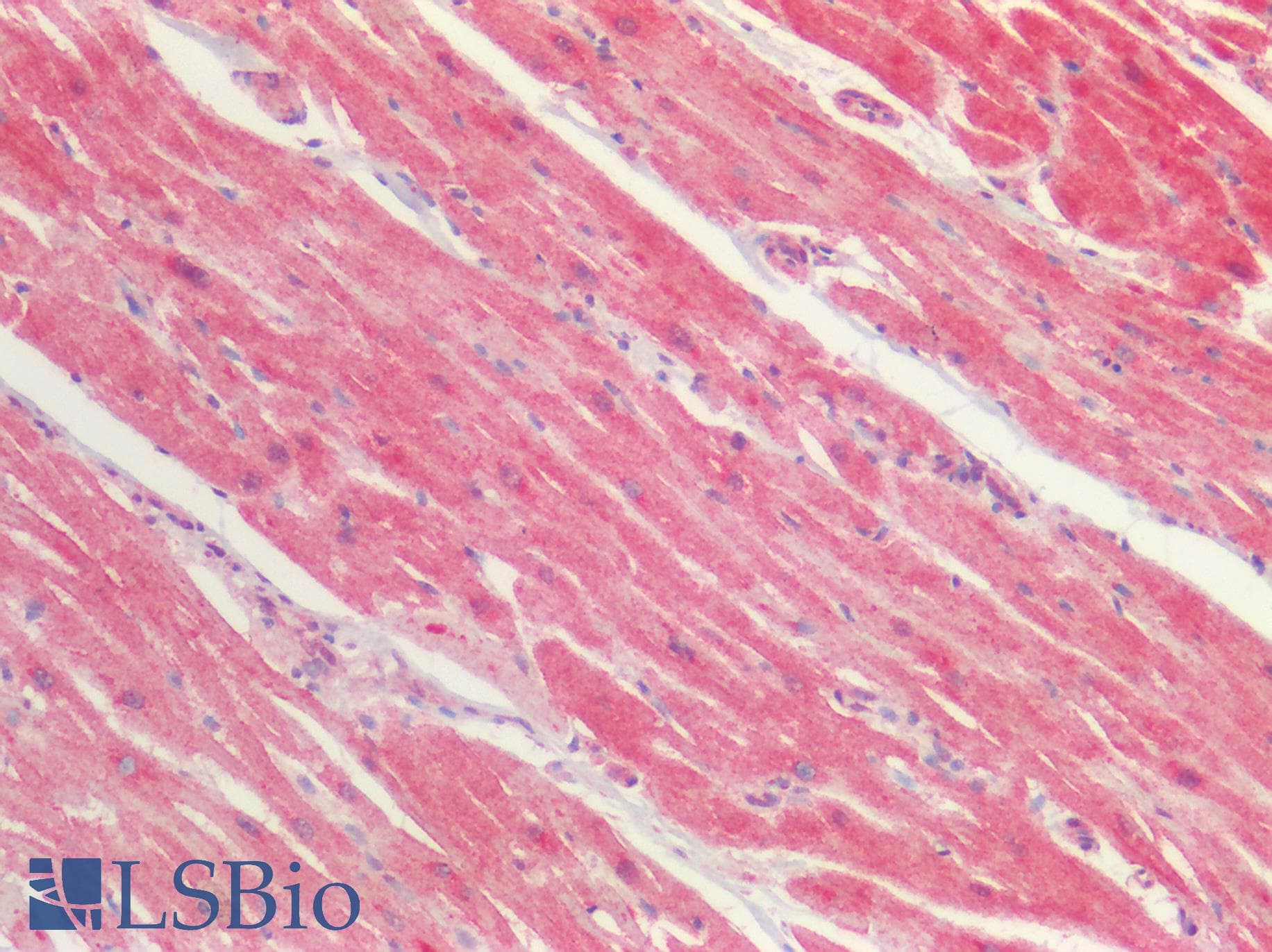 PathPlus™ EPHA4 / EPH Receptor A4 Antibody (Internal)