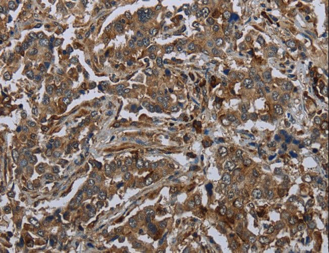 GLUL / Glutamine Synthetase Antibody