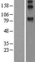 WFS1 Protein (Over-Expression Lysate Myc-DDK (Flag))