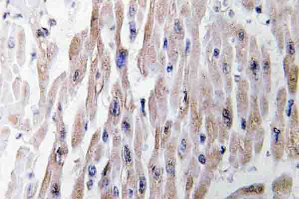 Polyclonal Rabbit anti-Human PFKFB2 Antibody (Tyr14, IHC, WB)