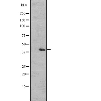 CCR2 Antibody