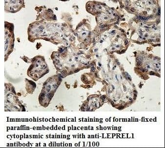 P3H2 / LEPREL1 Antibody (aa233-399)