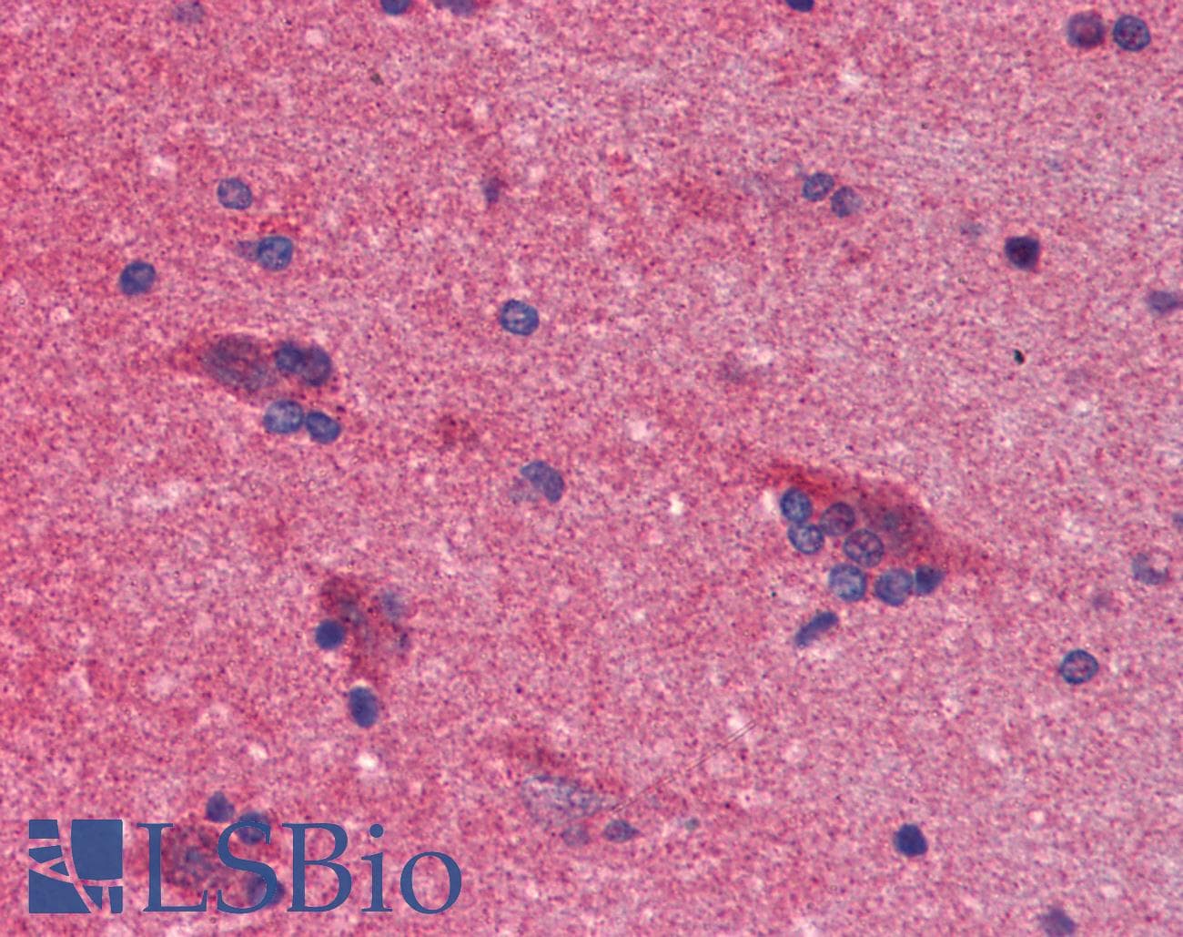 PathPlus™ Monoclonal Mouse anti-Human SNCA / Alpha-Synuclein Antibody (clone 5C2, aa1-140, IHC, WB)