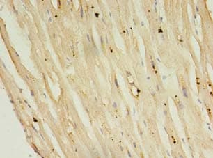 Polyclonal Rabbit anti-Human PLN / Phospholamban Antibody (IHC)