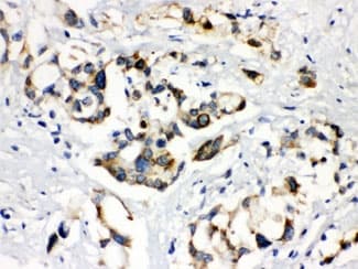 Polyclonal Rabbit anti-Human ABCB11 / BSEP Antibody (IHC, WB)