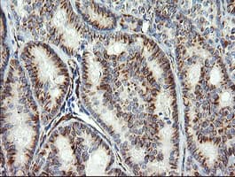 COPS6 / CSN6 Antibody (aa58-327, clone OTI4E7, Carrier-free)