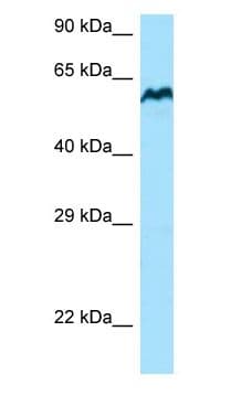 BCO1 / BCMO1 Antibody (C-Terminus)