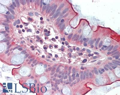 IHC-plus™ COL2A1 / Collagen II Alpha 1 Antibody (aa1228-1487)