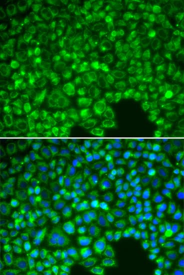 Polyclonal Rabbit anti-Human NFKBIA / IKB Alpha / IKBA Antibody (IHC, IF, WB)