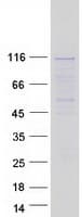 Human WDR59 Protein (Recombinant Myc-DDK (Flag))