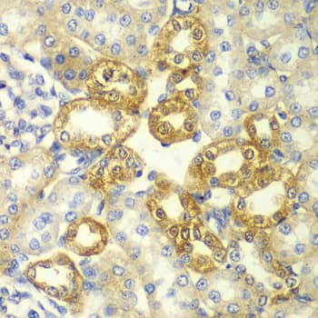 RICK / RIP2 Antibody