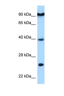 Polyclonal Rabbit anti-Human BID Antibody (aa159-208, WB)