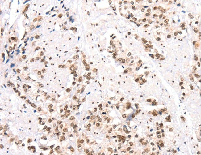 Polyclonal Rabbit anti-Human CTBP2 Antibody (IHC, WB)