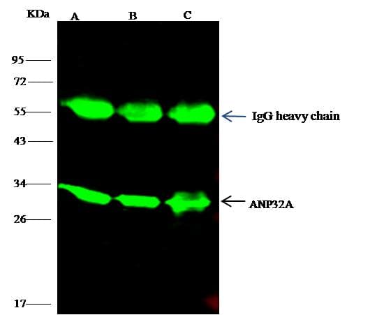 Polyclonal Rabbit anti-Human PHAP1 / ANP32A Antibody (Preservative Free, IHC, IF, WB)