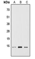 RPS19BP1 Antibody (Internal)